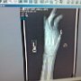 My Hand X-Rays